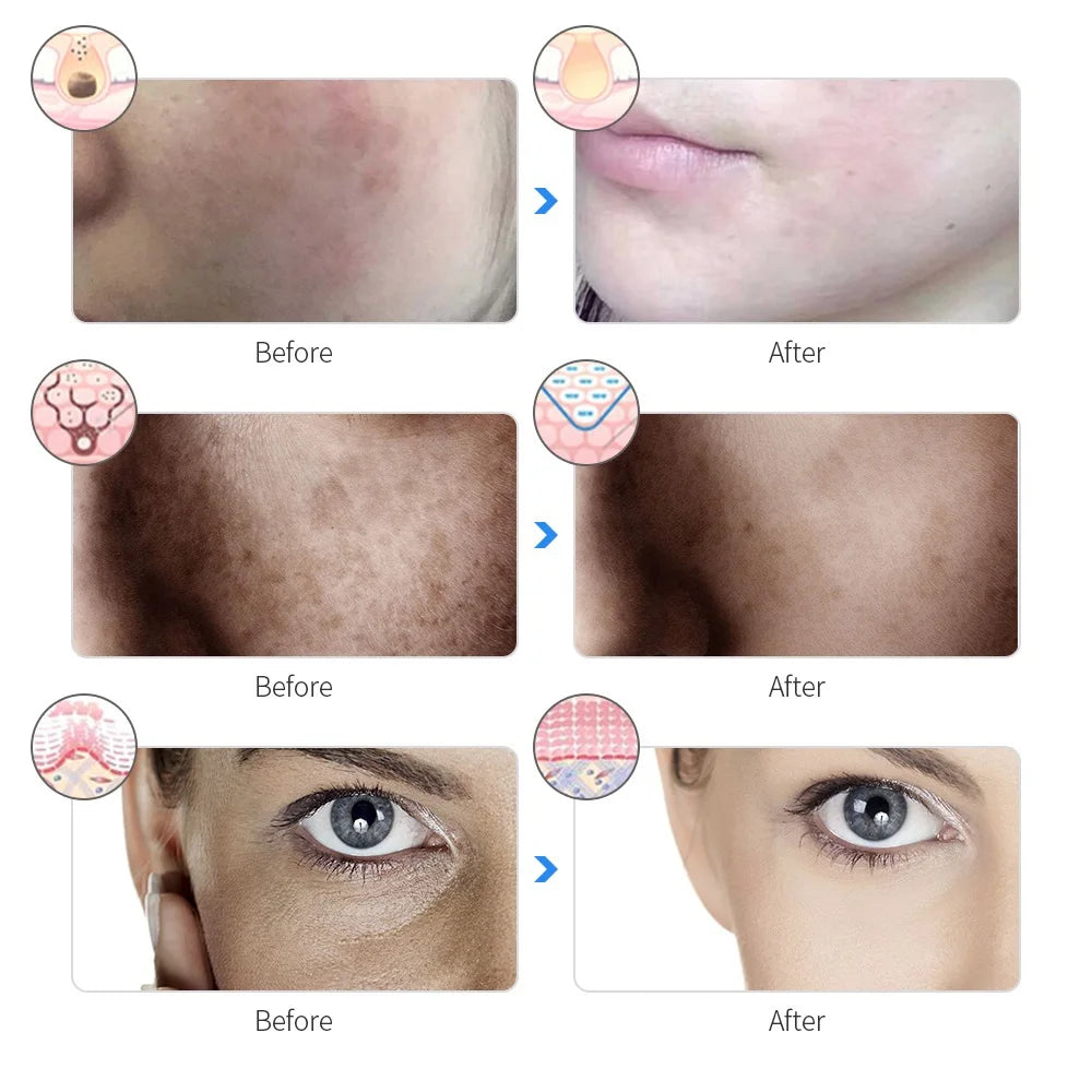 7 Color Rechargeable LED Facial Mask – Skin Rejuvenation and Anti-Aging Therapy