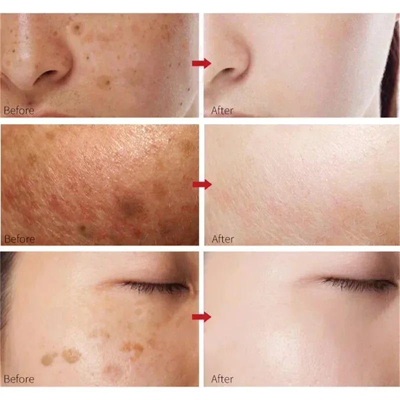 White Rice Face Whitening Cream – Brighten & Even Skin Tone Naturally