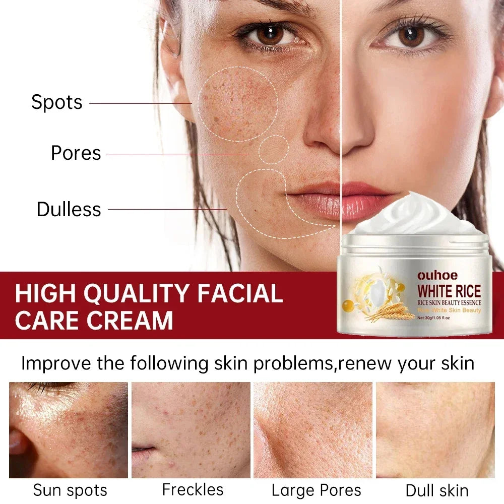 White Rice Face Whitening Cream – Brighten & Even Skin Tone Naturally