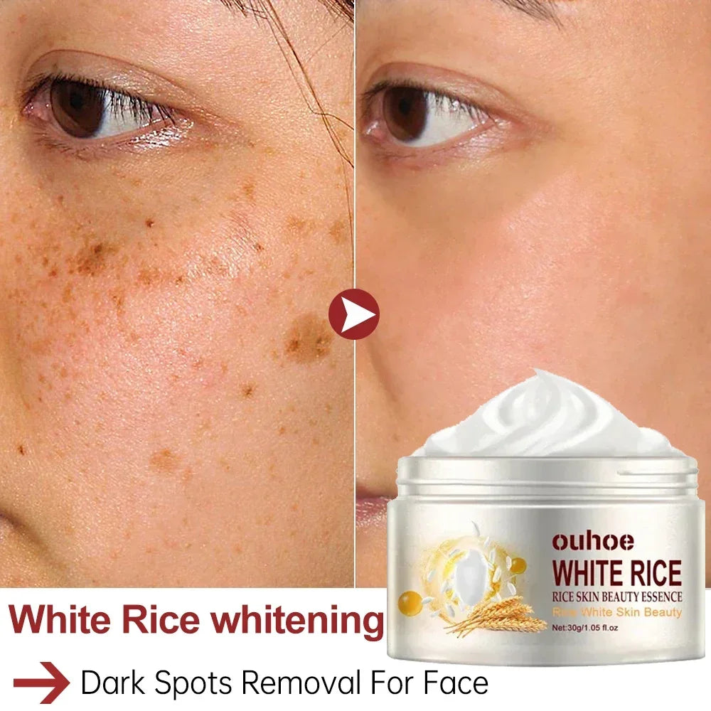 White Rice Face Whitening Cream – Brighten & Even Skin Tone Naturally