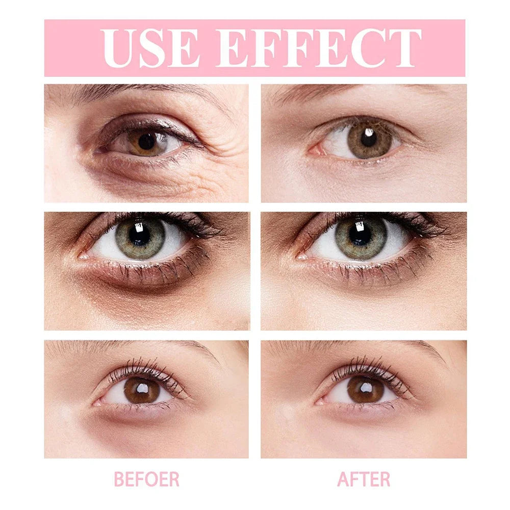 Anti-Wrinkle Eye Cream – Reduce Puffiness & Fine Lines for Youthful Eye