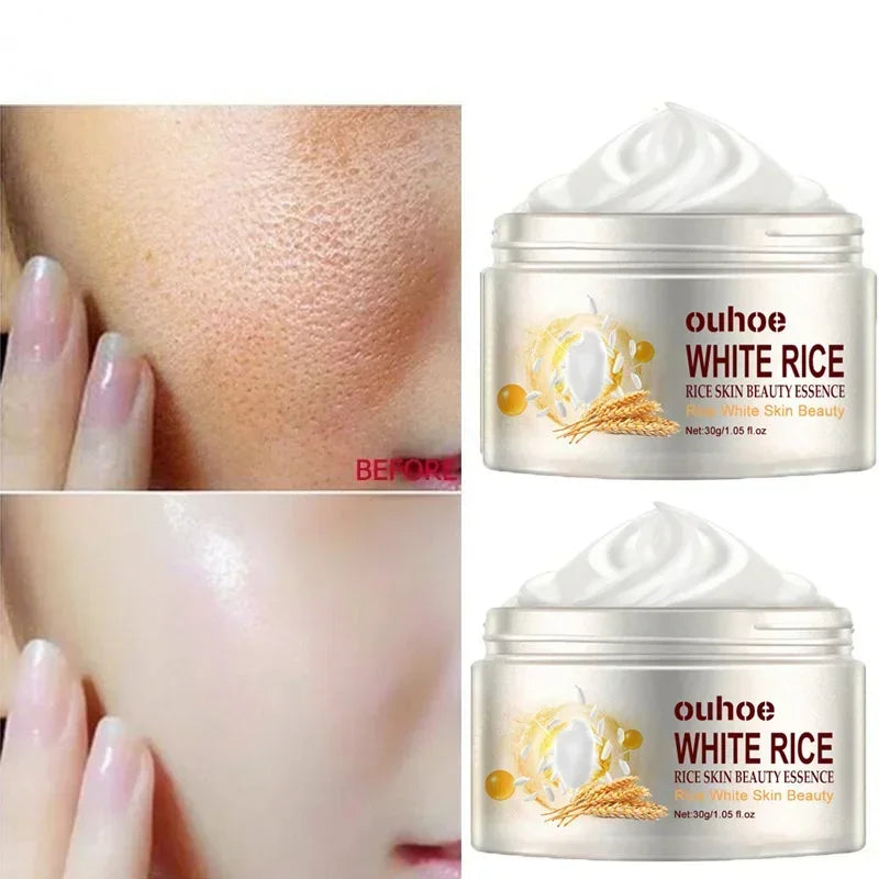 White Rice Face Whitening Cream – Brighten & Even Skin Tone Naturally